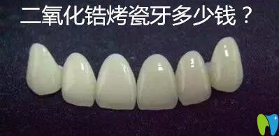 半贵金属烤瓷牙价格(半贵金属烤瓷牙价格表)